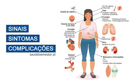 Lúpus: o que é, sintomas, tipos, causas e tratamento